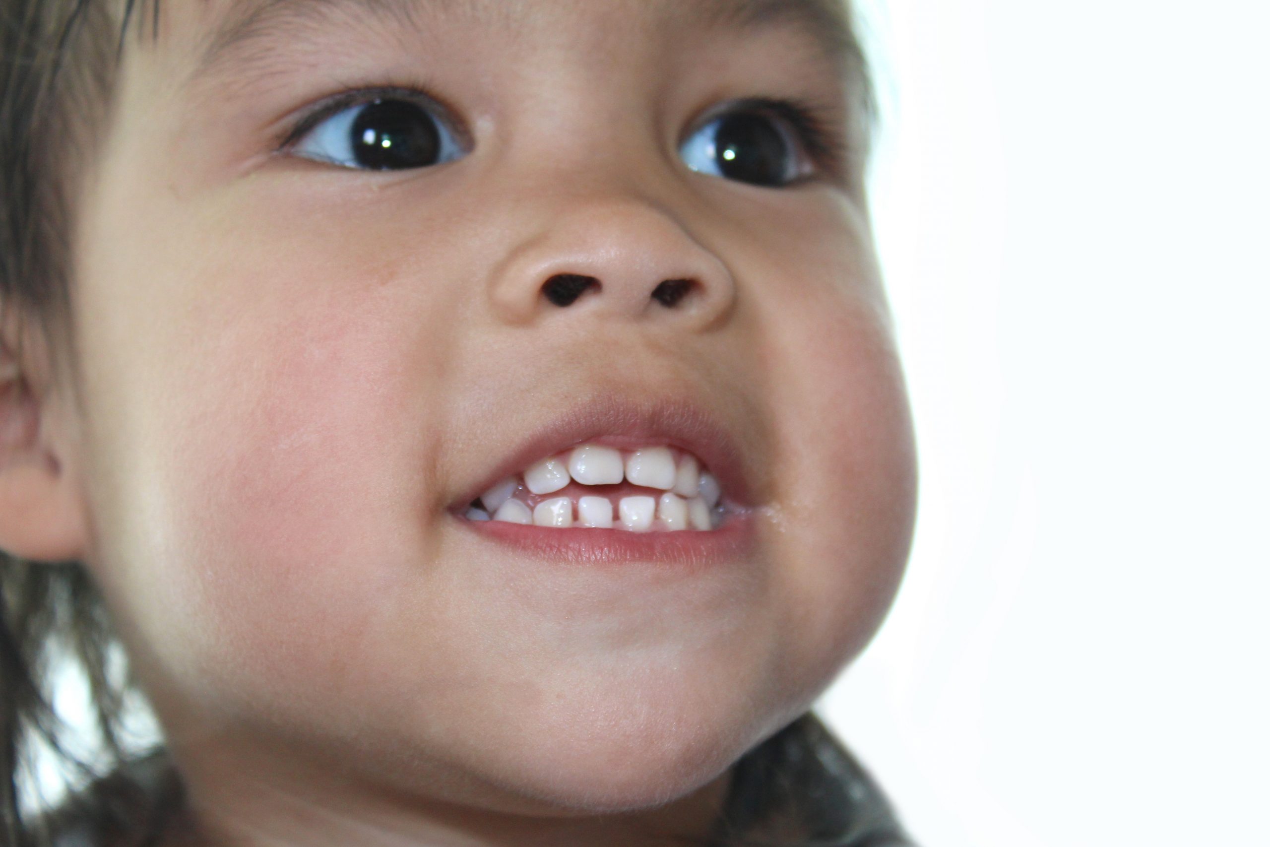 Closeup of child's teeth thumb sucking