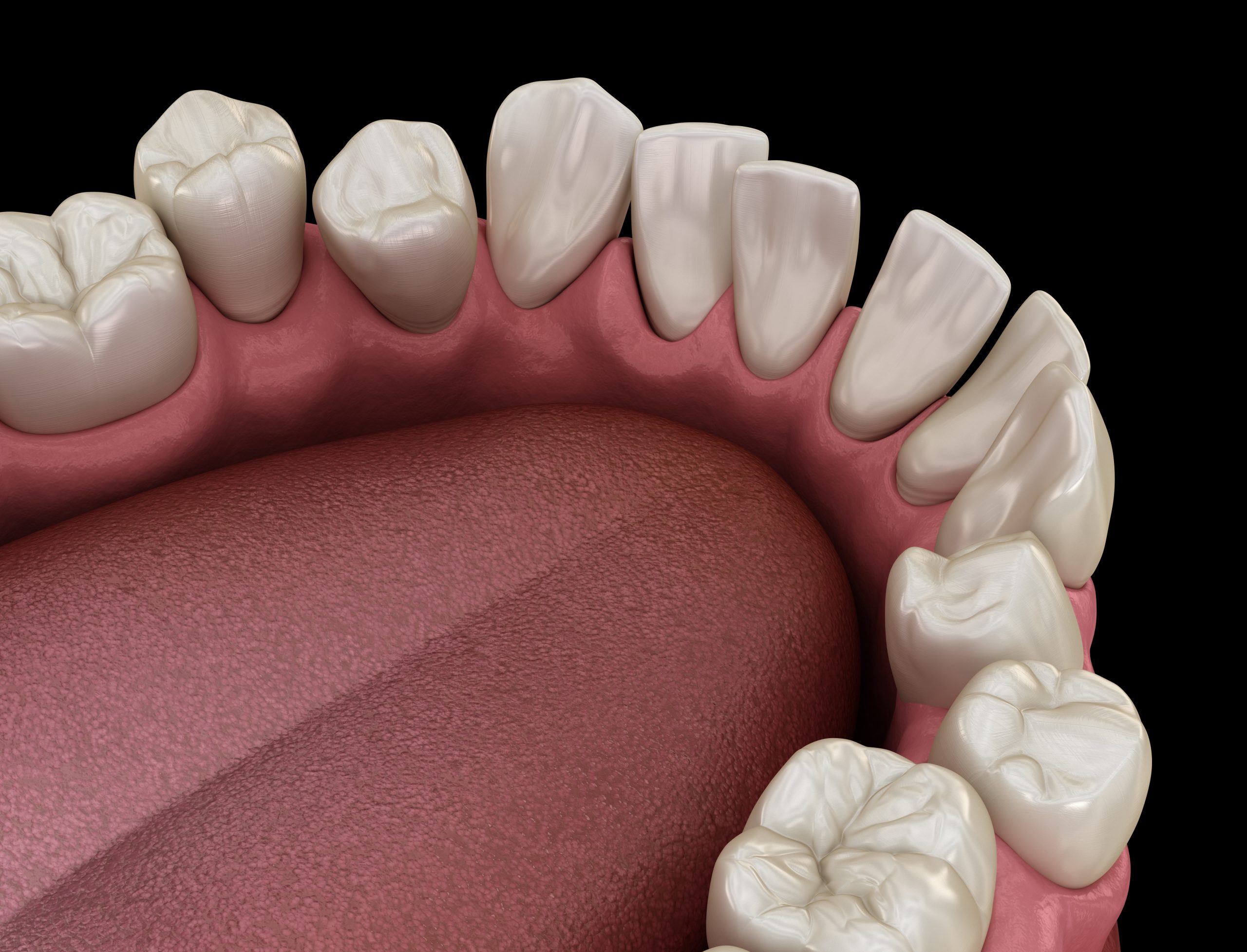 Abnormal teeth position