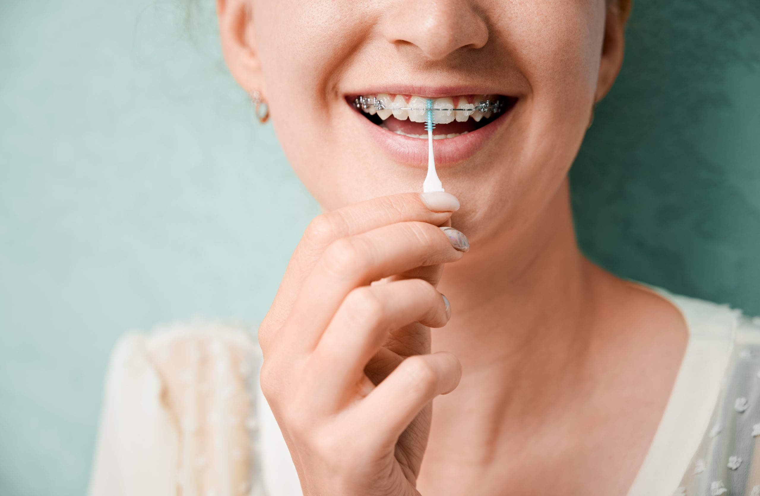 Young woman with braces on teeth