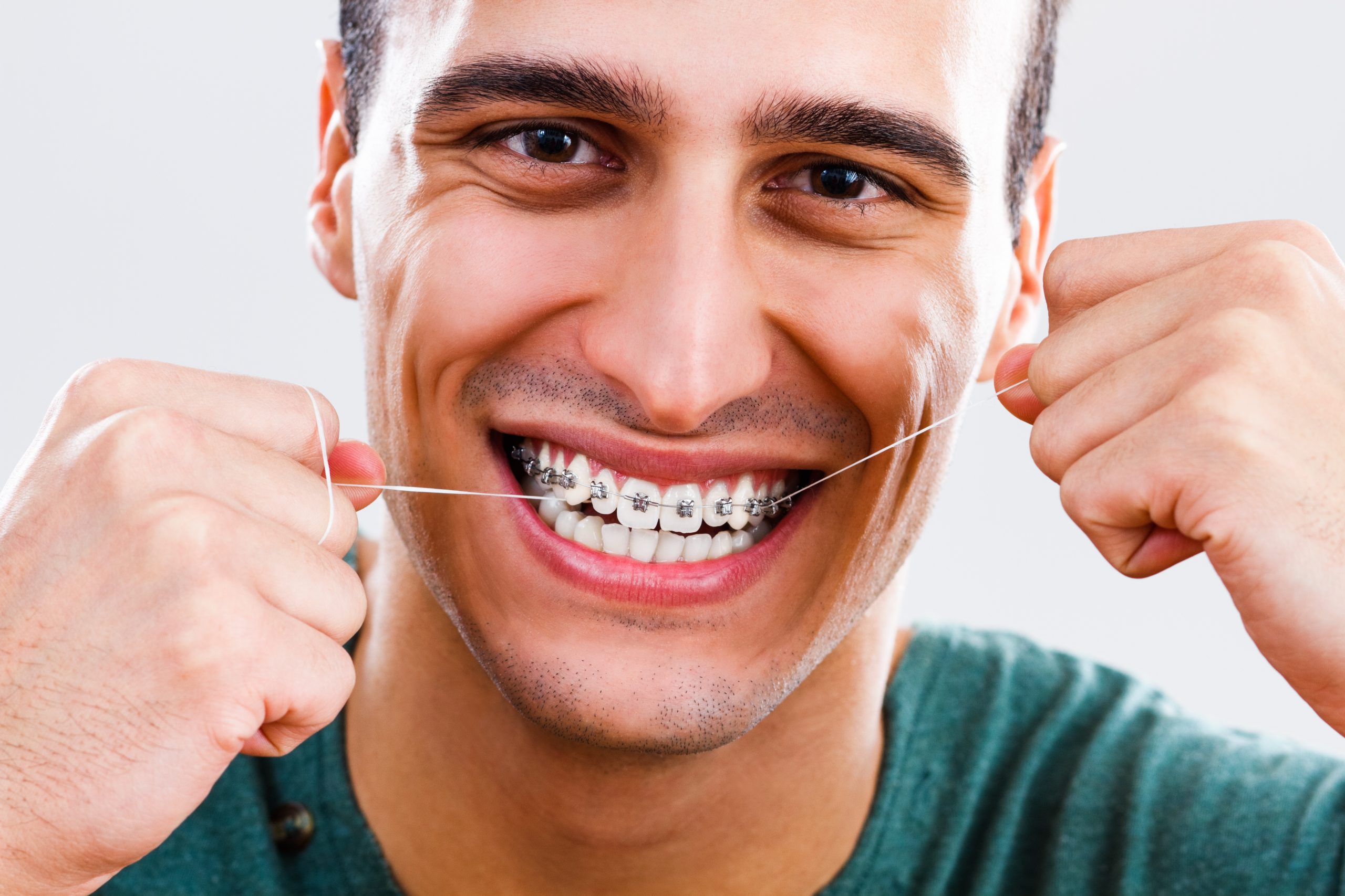 Adult Orthodontic Treatment