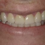 Cosmetic Dentistry