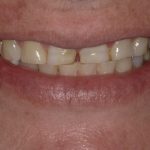 Cosmetic Dentistry