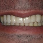 Cosmetic Dentistry