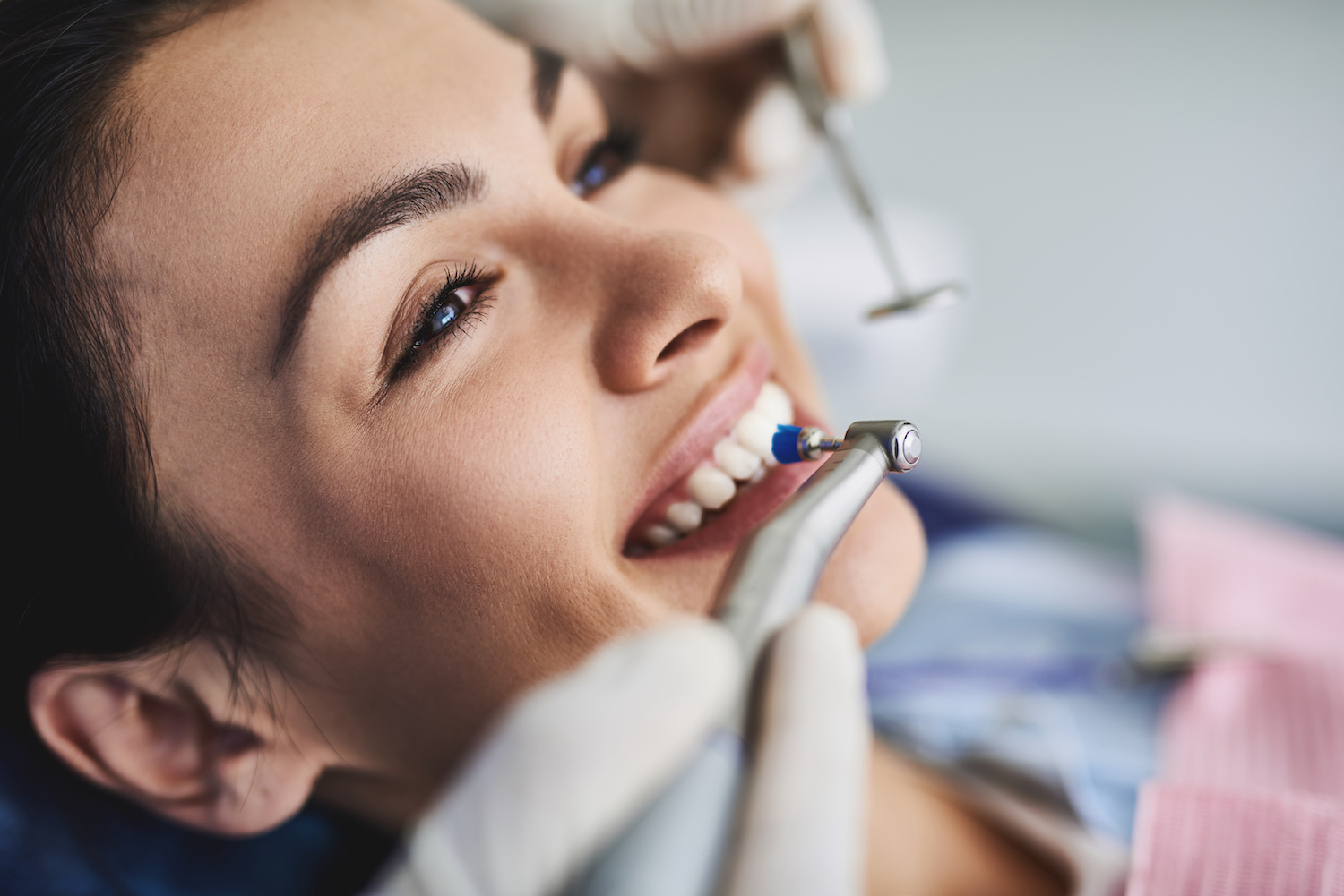 Teeth Cleaning in Kendall