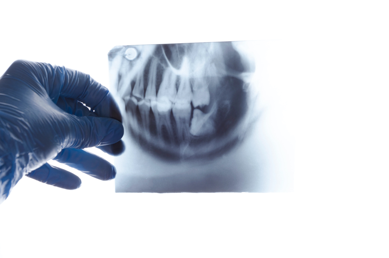 Dental X-Ray Miami FL