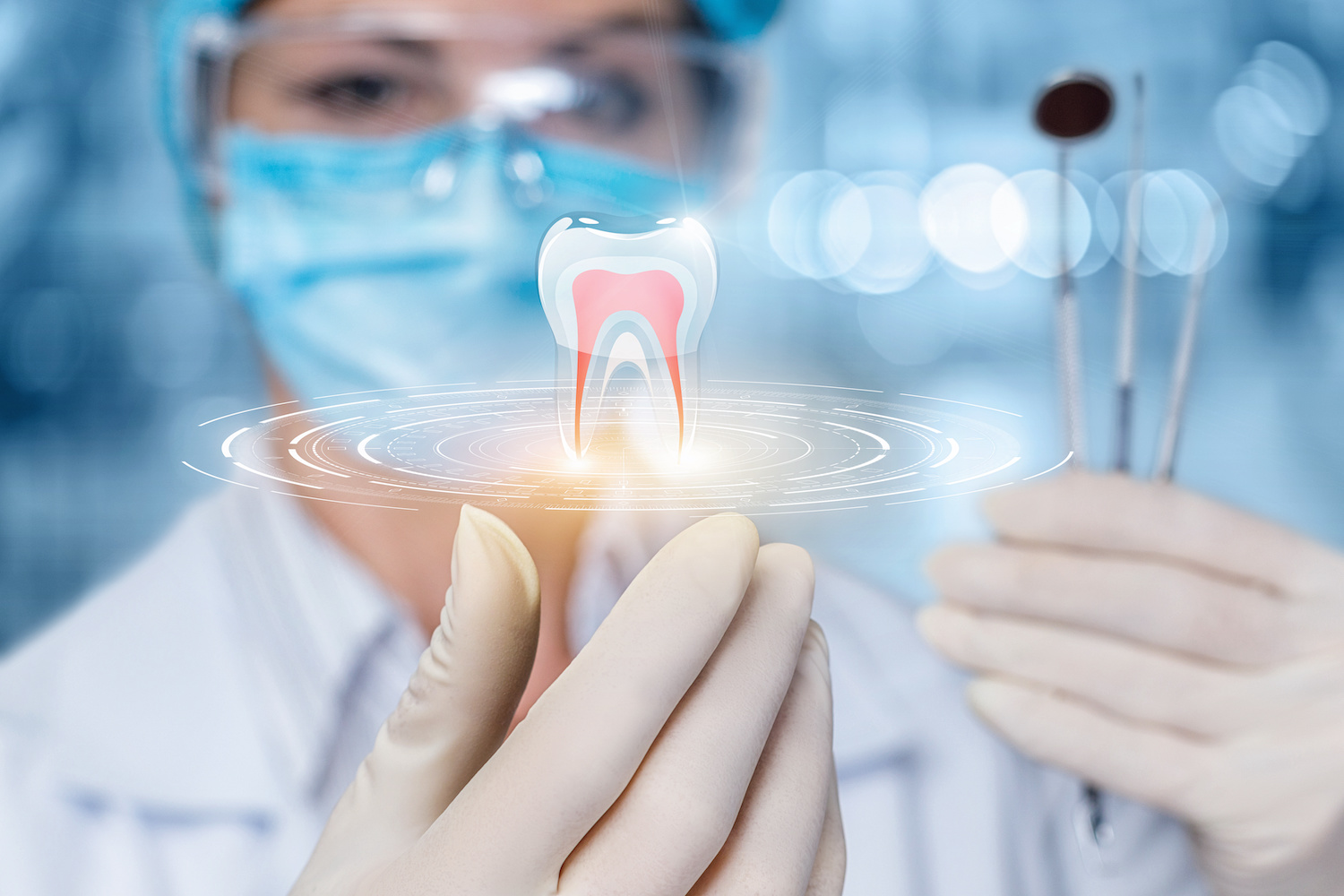 How to Prepare for a Root Canal in Coconut Grove