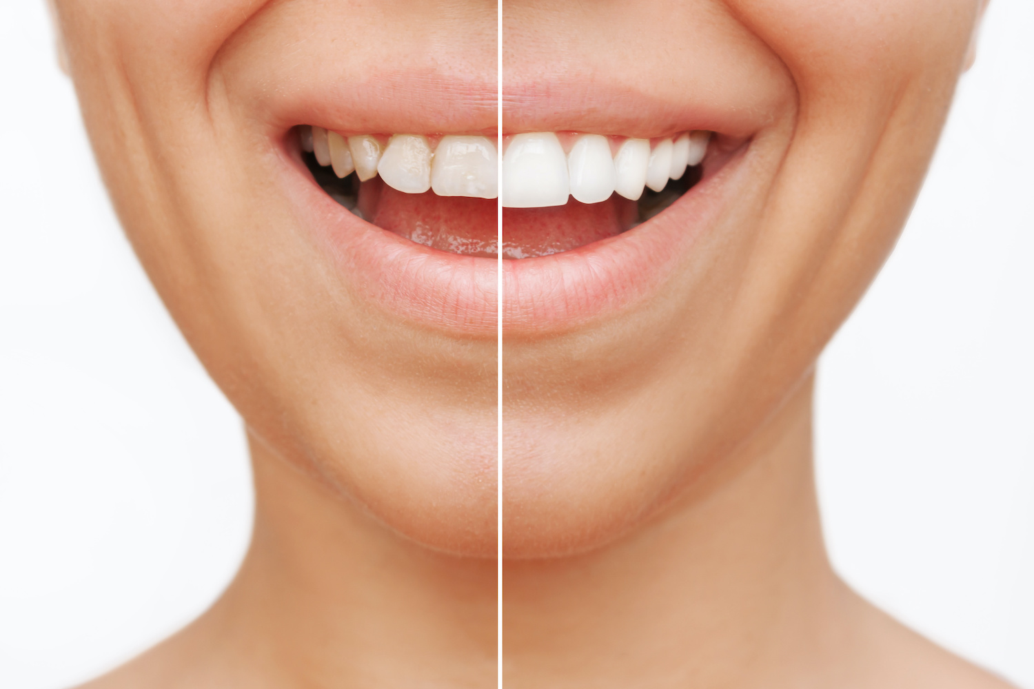 What Does a Cosmetic Dentist in Miami Do?