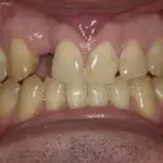 Cosmetic Dentistry
